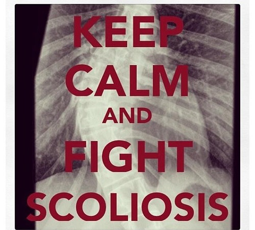 keep calm scoliosis